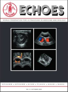 Echoes Issue No. 3  [October 2003]