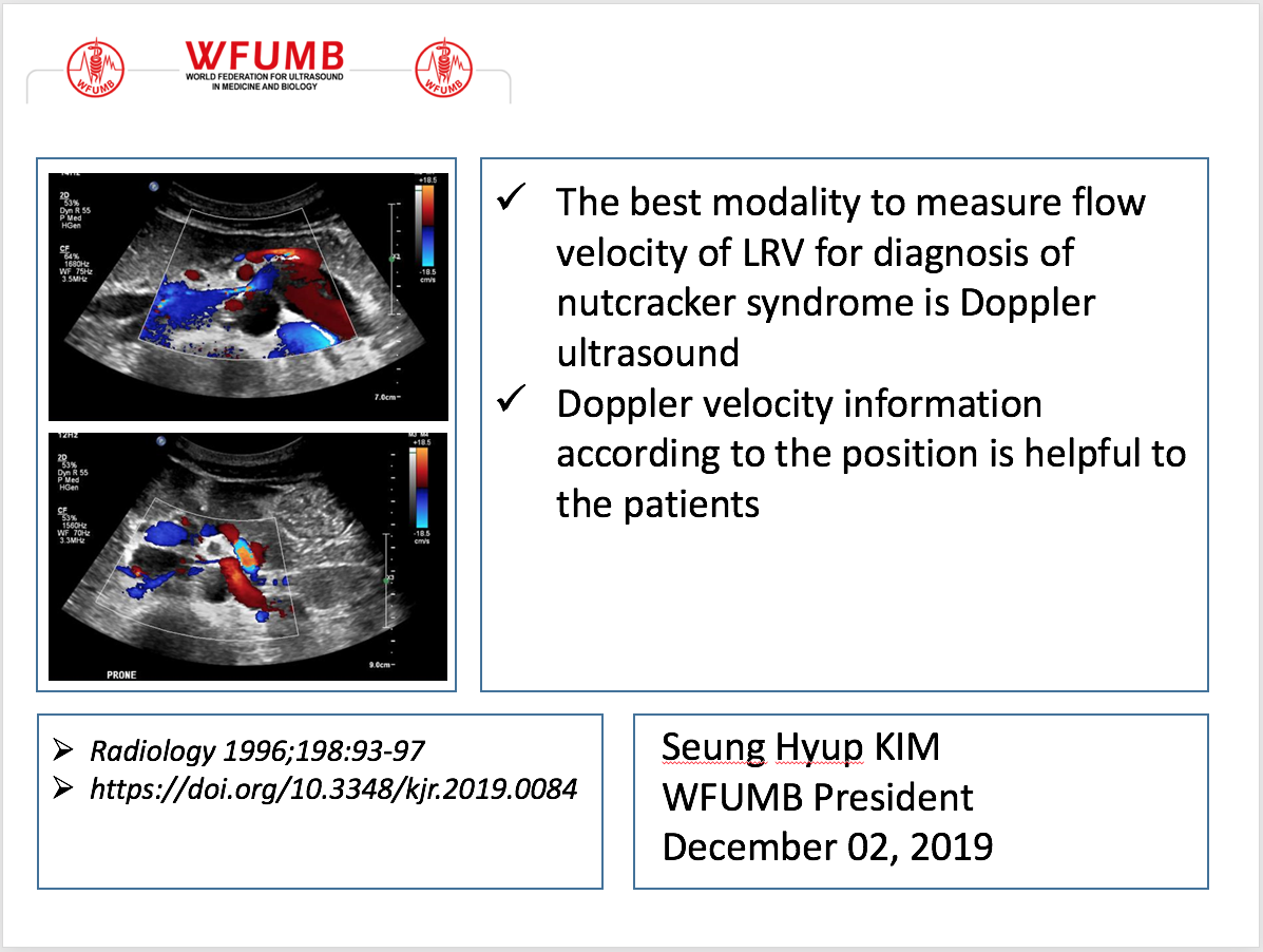 Ultrasound the Best 01 45/M, Proteinuria caused by nutcracker