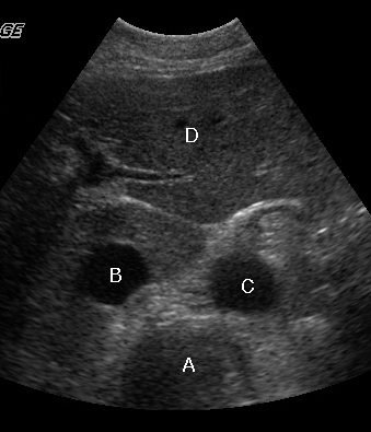 Aorta Anatomy Ultrasound