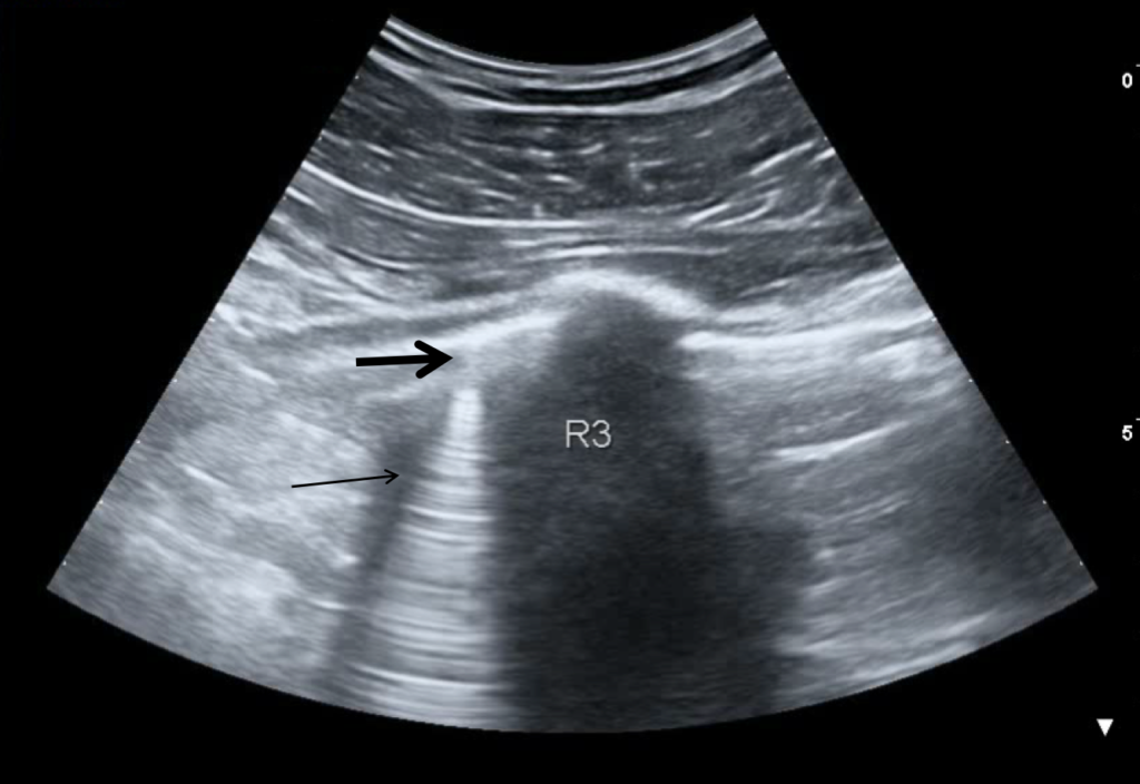 Principles of Ultrasound - OpenAnesthesia
