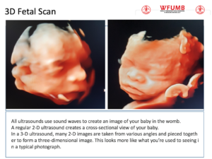 Ultrasound the Best #11: 3D Fetal Scan