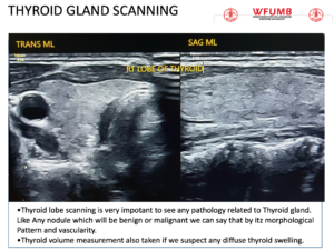 Ultrasound the Best #12: Thyroid gland scanning