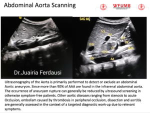 Ultrasound the Best #14: Abdominal Aorta Scanning
