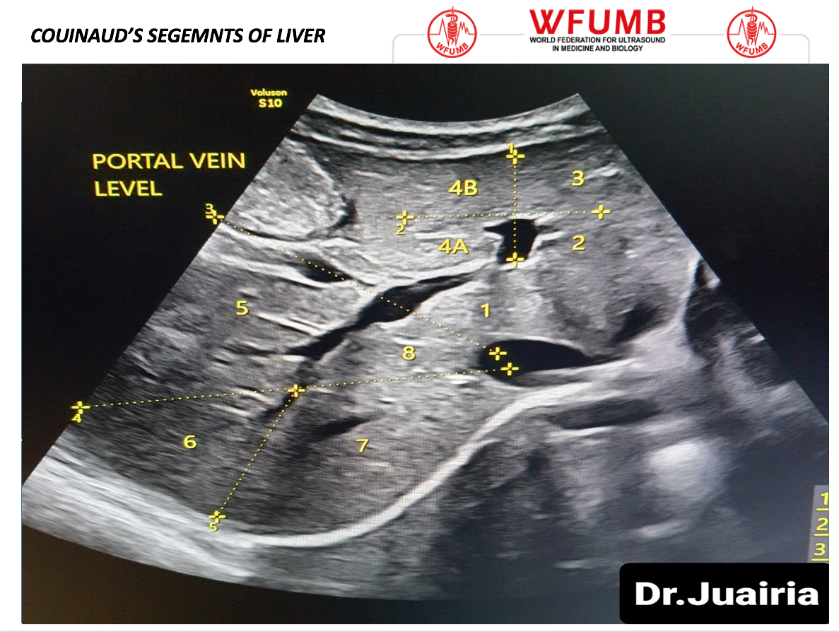Liver Segments On Ultrasound