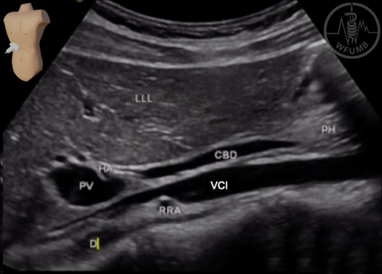 Liver Chapter 6 Media Library – WFUMB