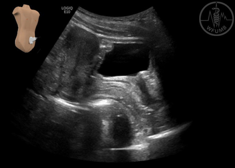 A structured systematic ultrasound examination of abdominal organs ...