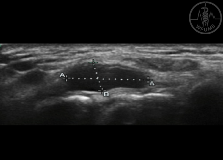 Introduction to Musculoskeletal Ultrasound – Chapter 24 Media Library ...