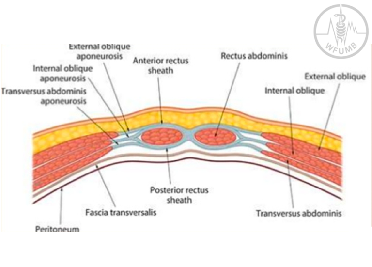 Abdominal Wall and Peritoneum – Chapter 30 Media Library – WFUMB