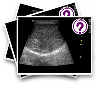 WFPI on X: Next webinar in our series- Ultrasound of the