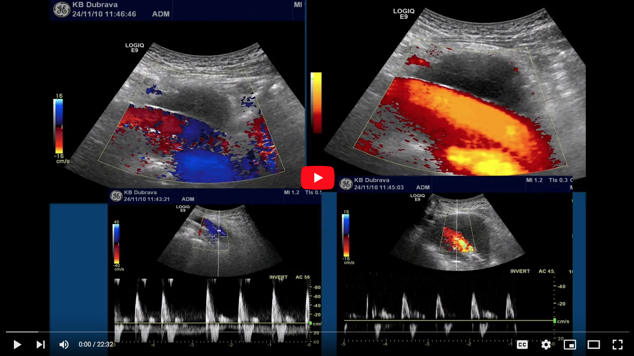 Vascular ultrasound in the area of CT and MRI ~ Boris Brkljacic ...