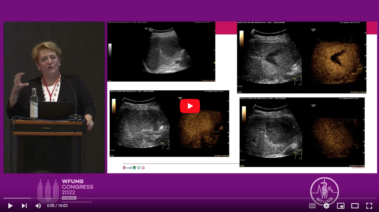 Difficulties In CEUS For Benign Focal Liver Lesions ~ Roxana Sirli ...